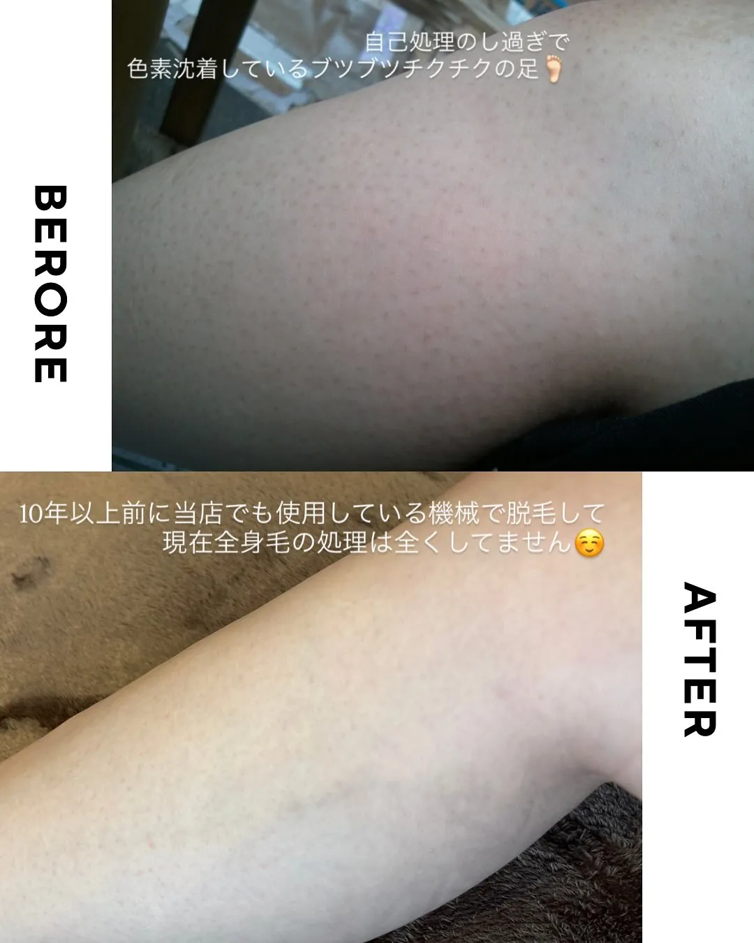 恥ずかしいですが…(笑)