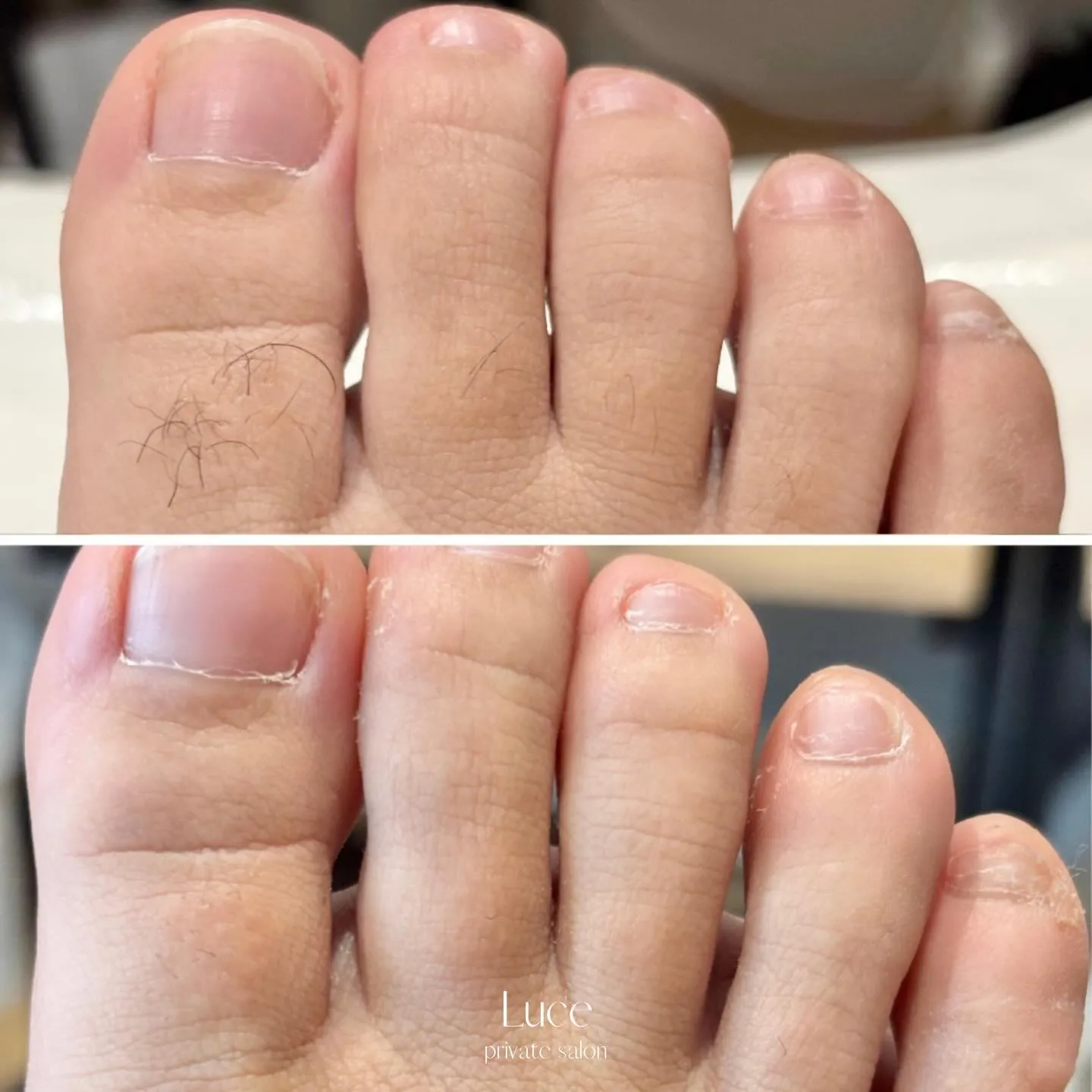 足の指毛さん🫣