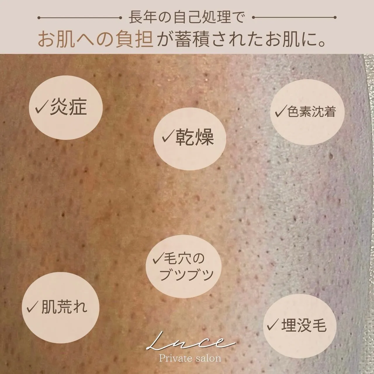 自己処理、続けるほどお肌に負担をかけているかもしれません💭