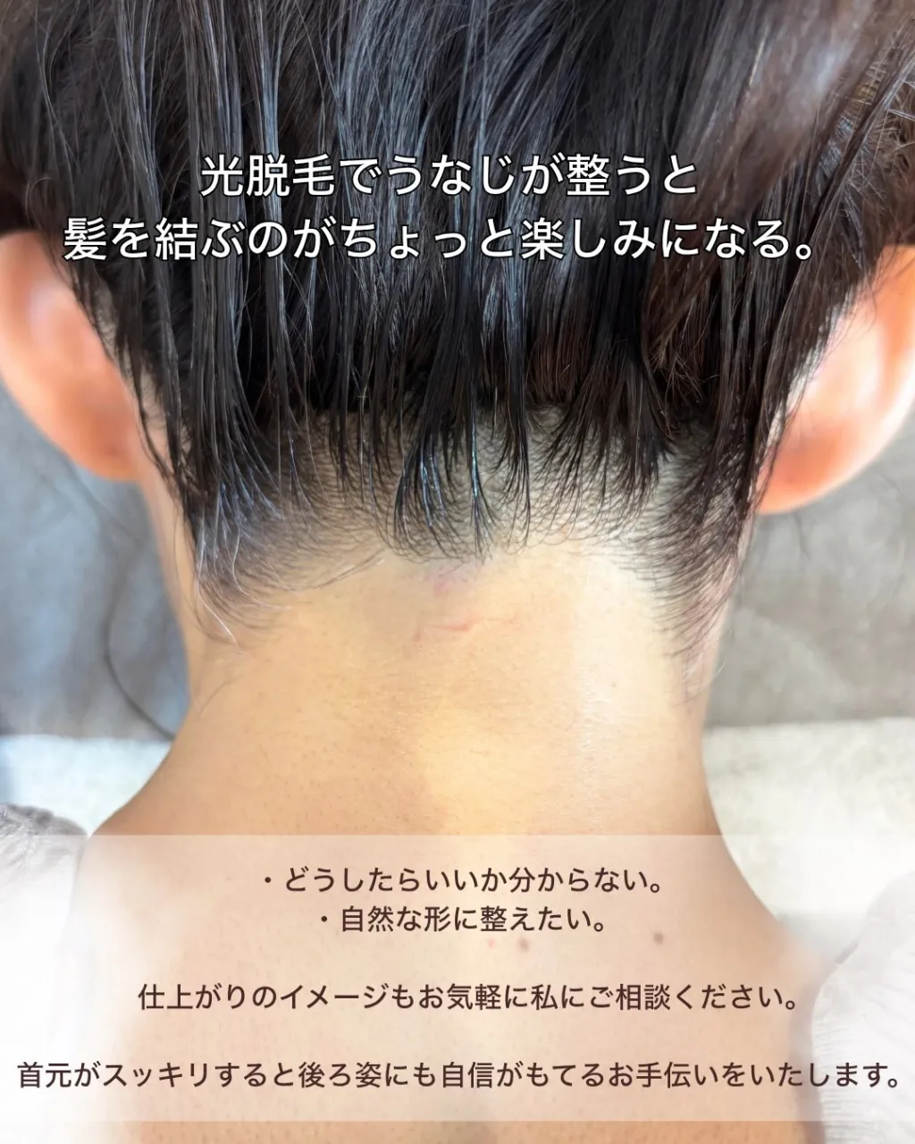 うなじ脱毛、するなら気になった今♡