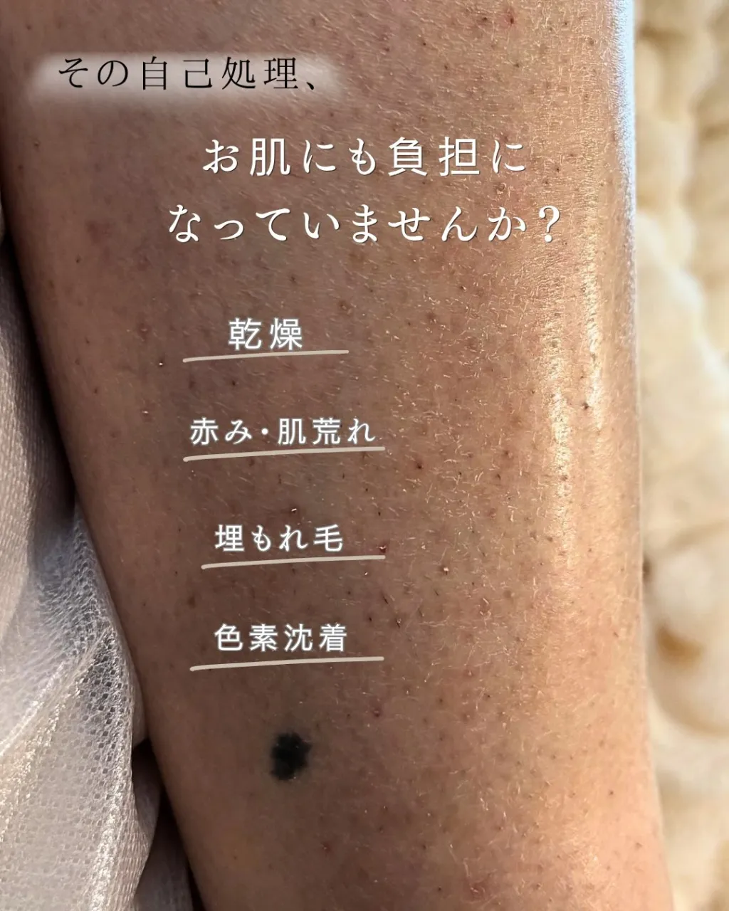 「剃ってもザラザラする」