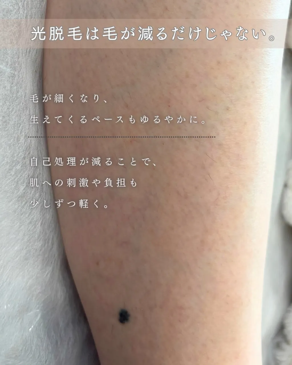 「剃ってもザラザラする」